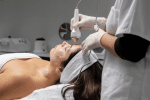 Guide to Finding the Right Skin Treatment