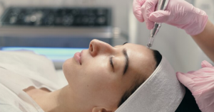 All You Need to Know About Microneedling Near You